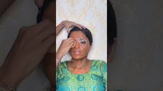 Vitiligo face makeup full tutorial✨😍 [upl. by Uball]