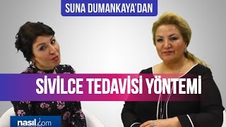 Sivilce nasıl geçer Suna Dumankayanın önerisi  Sağlık  Nasilcom [upl. by Atin]