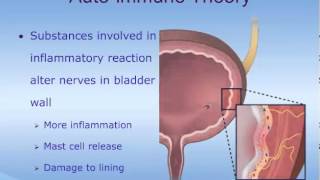 Understanding Interstitial Cystitis IC [upl. by Schoenfelder]