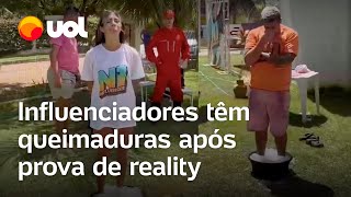 Influenciadores têm queimaduras após ficarem com pés mergulhados em gelo com sal para reality em PE [upl. by Nnylsia734]