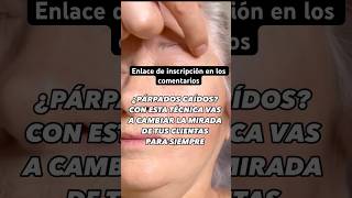 Lifting de los párpados exprés liftingfacial liftingsincirugia kinesiology [upl. by Survance]