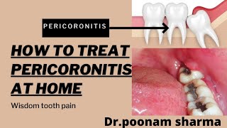 How to Treat Pericoronitis at Home Home Remedies for Pericoronitis [upl. by Towney]