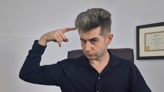 4 ways to tell Finasteride is working for hair loss [upl. by Kora]