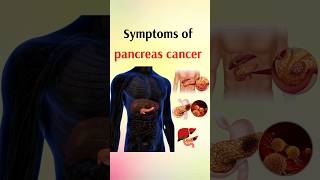 symptoms of pancreas cancer shorts [upl. by Jahdai]