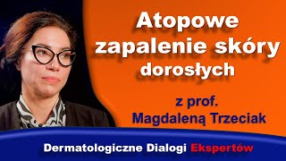 Atopowe zapalenie skóry dorosłych 2025 Od diagnostyki do leczenia [upl. by Isoais]