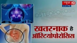 Sanjeevani  Osteoporosis  20 October 2016 [upl. by Eenel]