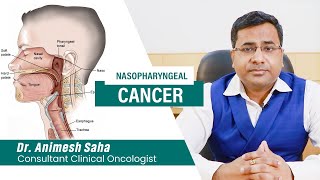 Nasopharyngeal cancer awareness  Best Oncologist in Kolkata  Cancer Specialist in Kolkata [upl. by Lenahc]