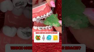 5 CRYSTAL CANDIES to AVOID with braces what to eat instead crunchy sounds shorts asmr braces [upl. by Atarman745]