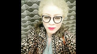 Albinos et forte Pernelle Obame  Gabon [upl. by Marina589]