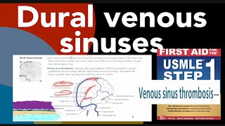 Dural venous sinuses  Venous sinus thrombosis in HindiUrdu by first aid for the USMLE step 1 [upl. by Edylc829]