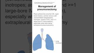 Management of pneumonectomy [upl. by Maridel107]