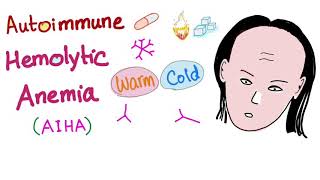 Autoimmune Hemolytic Anemia AIHA  Warm autoantibodies IgG  Hematology [upl. by Pfeifer]