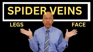 Spider Veins on the Face versus Spider Veins on the Legs 3 Differeneces for Doctors and Nurses [upl. by Pedaias]