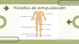 Fisioterapia en pacientes amputados [upl. by Ttnerb635]