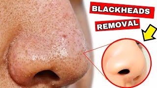 How To Remove Blackheads And Clogged Pores From Your Nose Permanently [upl. by Aneehsor]