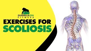 Exercises For Scoliosis  Unilateral Back Training [upl. by Brion84]