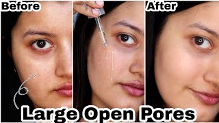 Finally a Product That Works for Large Open Pores [upl. by Nasar197]