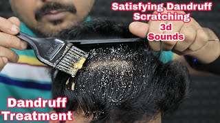 Satisfying Dandruff Scratching ASMR Dandruff Treatment by biswajit barber [upl. by Nahej]