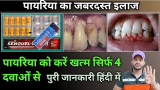 treatment of pyorrheaपायरिया का बेस्ट इलाज [upl. by Akener470]