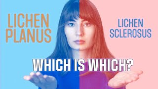 Lichen Sclerosus and lichen planus whats the difference [upl. by Stiegler]