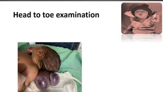 Head to Toe Examination in Newborn I Newborn Examination Part3  Paediatrics [upl. by Lorenz]