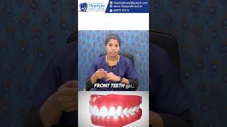 Overjet னா என்ன overbite னா என்ன  thanjaidental dentalcare oralhealth [upl. by Ehlke]