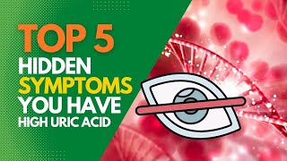 5 Hidden Symptoms You Have High Uric Acids [upl. by Yeltihw]