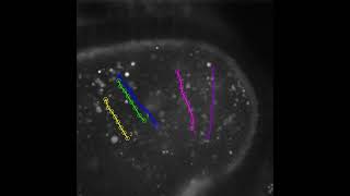 Cytoplasmic Streaming of Female Drosophila at Stage 11 Oogenesis Manual Particle Tracking SC [upl. by Fassold636]