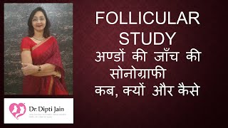 FOLLICULAR STUDY अण्डों की जाँच की सोनोग्राफी COMPLETE DETAILS HINDI [upl. by Crosby]