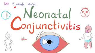 What Causes Conjunctivitis  CONJUNCTIVITIS  PinkEye  The Dr Binocs Show  Peekaboo Kidz [upl. by Iruyas334]