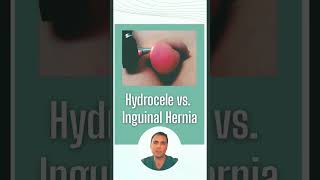 Hydrocele vs inguinal hernia [upl. by Euqinad326]