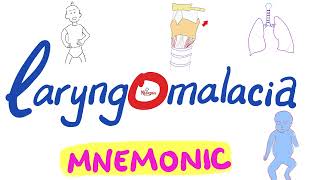 Laryngomalacia Mnemonic  Pediatrics ENT [upl. by Atcele]