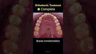 trending dentist dentalclinic orthodontist dental smile braces dentistry shorts yt bds [upl. by Karame243]