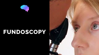 Fundoscopy Ophthalmoscopy  OSCE Guide  UKMLA  CPSA [upl. by Danie]