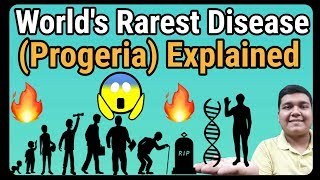 Progeria Syndrome Explained  How it is caused [upl. by Ahkos]