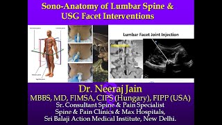 ULTRASOUND ANATOMY OF LUMBAR SPINE amp USG FACET INTERVENTION Dr Neeraj Jain MBBS MD CIPS FIPP USA [upl. by Namara]