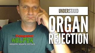 Understanding Post Transplant Organ Rejection [upl. by Gaby]