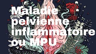 Maladie pelvienne inflammatoire ou MPU [upl. by Naihtniroc]