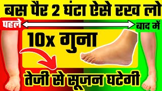 पैरों की सूजन घटाने का चमत्कारी उपायLeg Swelling TreatmentSciatica Pain Relief Exercises [upl. by Jamima]