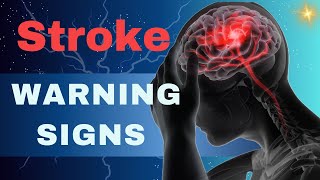 Stroke Warning Signs and 10 Tips for Prevention [upl. by Chesney944]