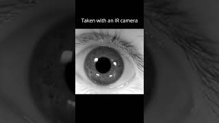 Voluntary Nystagmus with a High Resolution IR Camera Slow Motion [upl. by Maiga651]