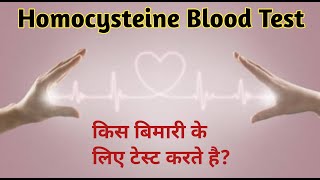 Homocysteine blood test  homocysteine  homocysteine test [upl. by Eetnod]