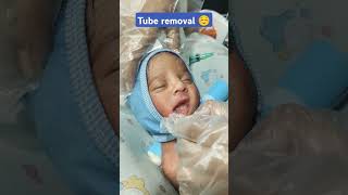 Tube removal babycare nicu babyfeedingtrendingshorts [upl. by Tijnar]