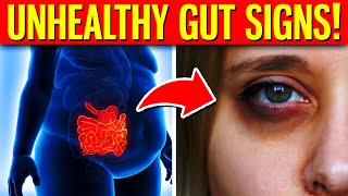 10 Warning Signs You Have An UNHEALTHY Gut [upl. by Clare]