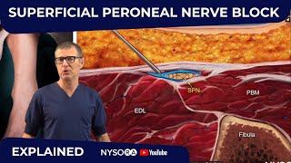 Superficial Peroneal Nerve Block  Crash course with Dr Hadzic [upl. by Clancy191]