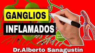 Signos PELIGROSOS en GANGLIOS LINFÁTICOS INFLAMADOS Adenopatías [upl. by Aurora]