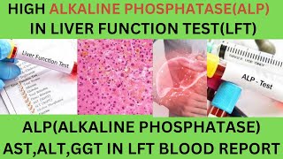 Liver Function Test Report Interpretation LFTsASTALTALP CAUSES OF HIGH LOW ALKAINE PHOSPHATASE [upl. by Hakan491]