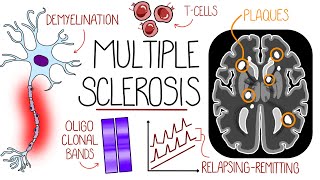 Understanding Multiple Sclerosis Multiple Sclerosis Explained [upl. by Kellene]