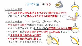 ソフトペッサリー サザエ法抜去のコツ How to remove vaginal pessary [upl. by Berkley]