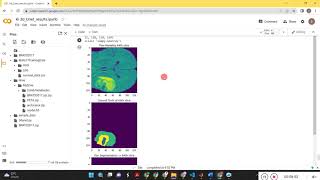 3DUnet model for Brain tumor segmentation  Brats Dataset Python [upl. by Pelagia835]